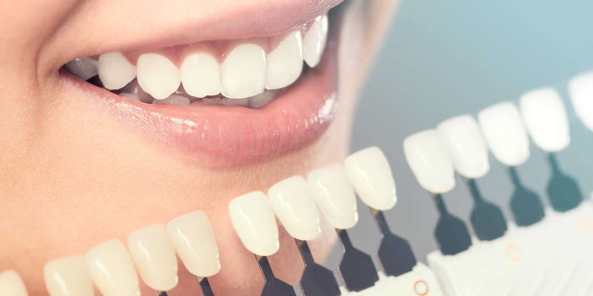 Brighten Your Smile: Teeth Whitening in McKinney, Texas